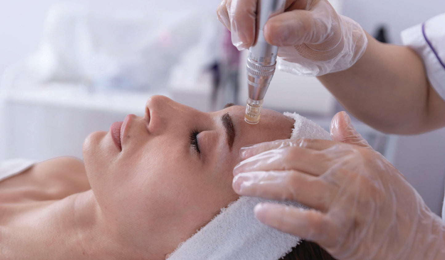 Stem Cell Microneedling